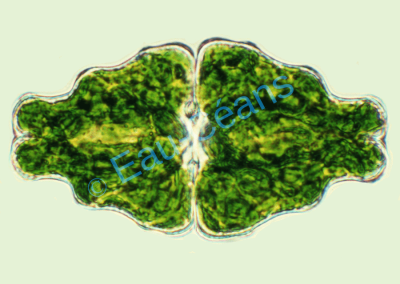 "Euastrum", algue microscopique d'eau douce verte (L : 0,250mm)
