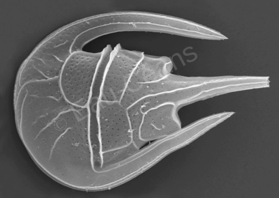 Une dinophyte marine vue au microscope électronique à balayage (L : 0,150mm)