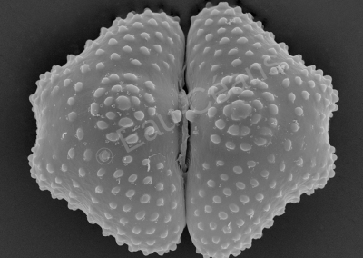 Algue microscopique verte d'eau douce vue en microscopie électronique à balayage (L : 0,050mm)